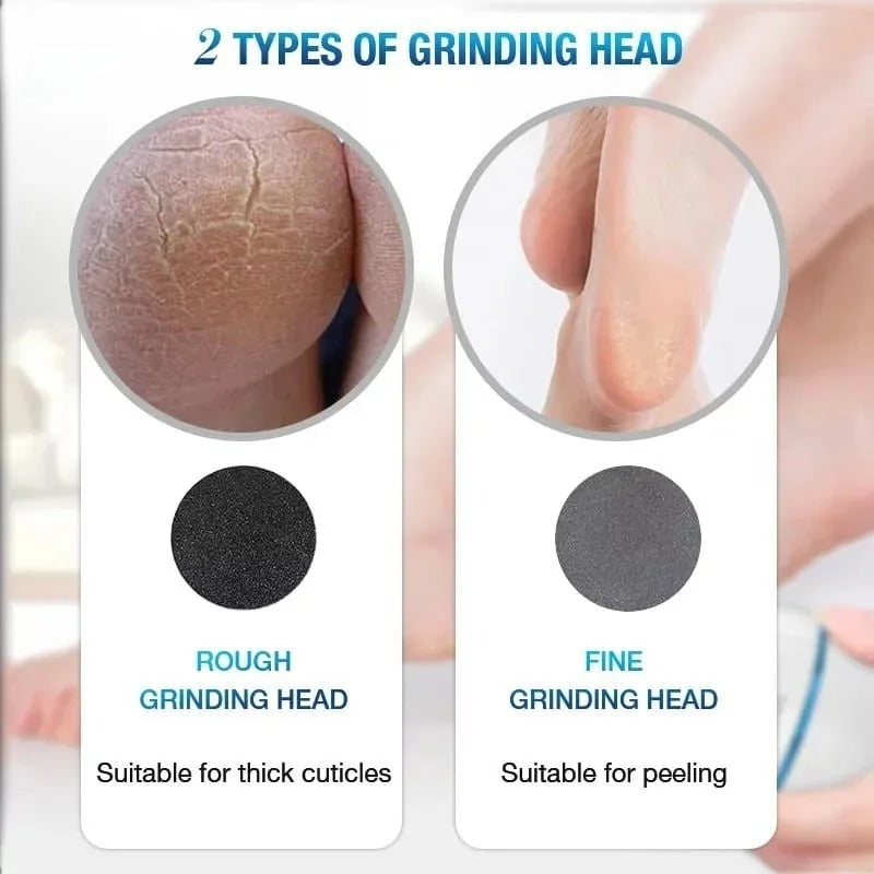Back Callus Remover with Built-In Vacuum – Electric Foot Grinder for Dead Skin, Cracked Heels & Calluses, Rechargeable Pedicure Tool with Gentle & Powerful Exfoliation